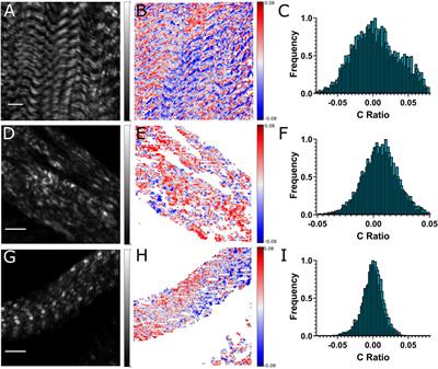 Second Harmonic Generation Properties in Chiral Sarcomeres of Drosophila Larval Muscles